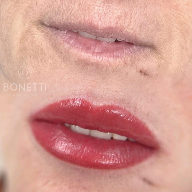 bonetti-gallery-lips-03
